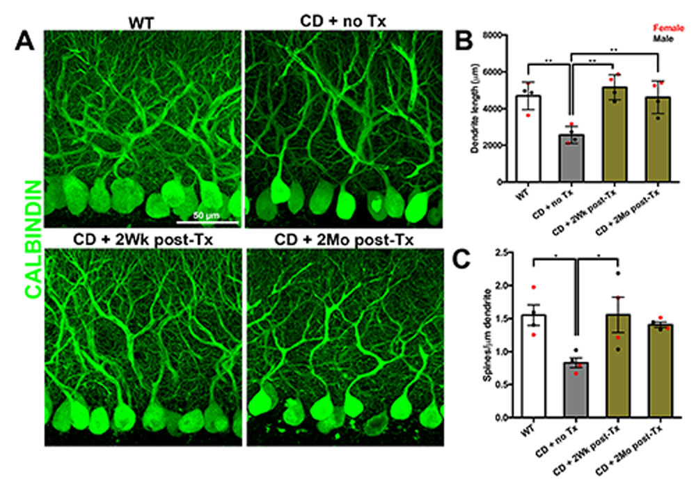 Purkinje-cells