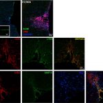 Early perivascular and subpial neutrophil- and lymphocyte-rich inflammatory infiltrates in MOG peptide EAE mice