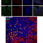 Axons are damaged within spinal cord inflammatory infiltrates in MOG peptide EAE mice
